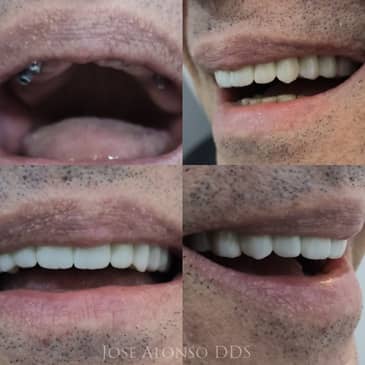 Slider image (2) Jose Alonso DDS